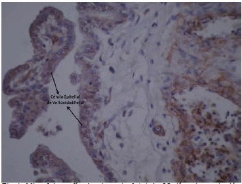 Determinación de Receptores de Progesterona en Placenta Fetal Durante la Placentación Porcina - Image 1