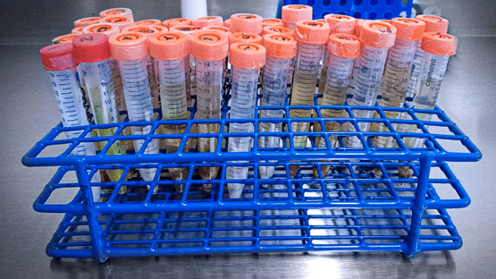 Conjunto de muestras en hisopos para diagnósticos