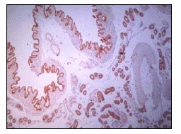 Comparación de técnicas de recuperación antigénica en placentas y úteros porcinos para la determinación de receptores de progesterona - Image 1