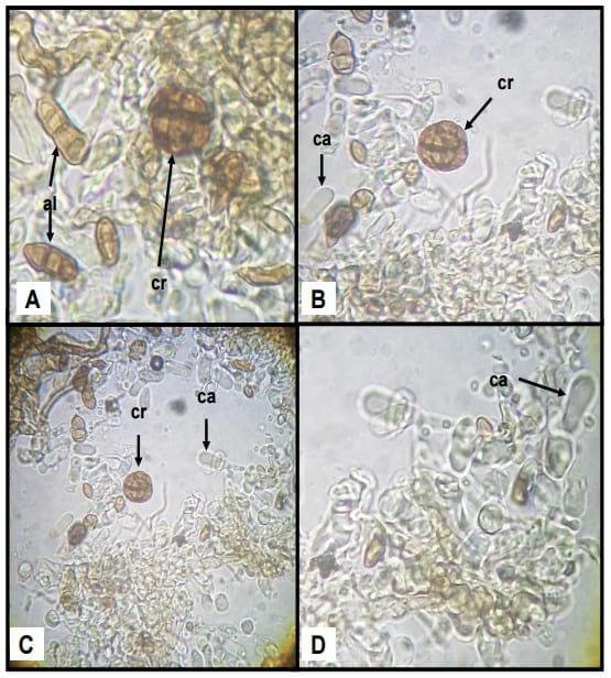 Detección de Ergot (claviceps africana) en semilla de sorgo comerciales. - Image 2