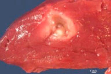 Cysticercus Cellulosae en carne de cerdos, Técnicas para eliminarlo - Image 19