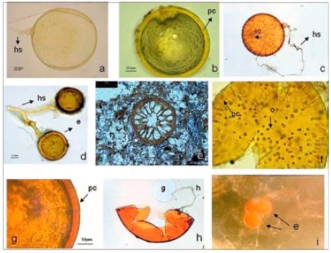 La micorriza arbuscular (MA) centro de la rizosfera: comunidad microbiológica dinámica del suelo - Image 3