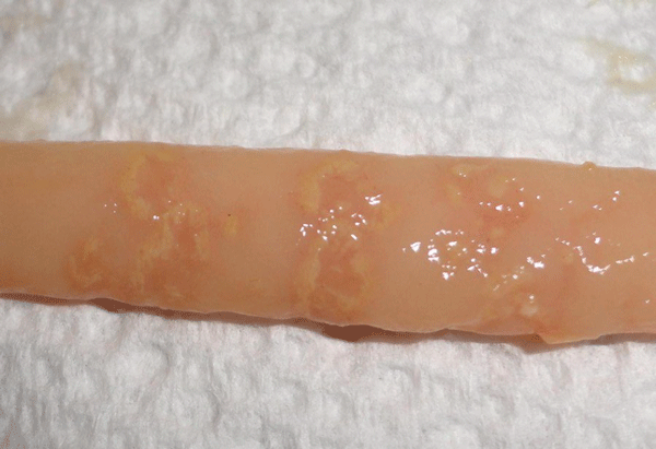 Figura 3. Intestino delgado de un pollo de engorde con ulceras necróticas en la mucosa, lesiones típicas de enteritis necrótica subclínica. Fotografía por: Dr. Lorenzoni.