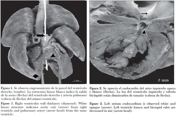 Informe de un caso de doble tracto de salida del ventrículo derecho e hipoplasia del ventrículo izquierdo en un perro - Image 1
