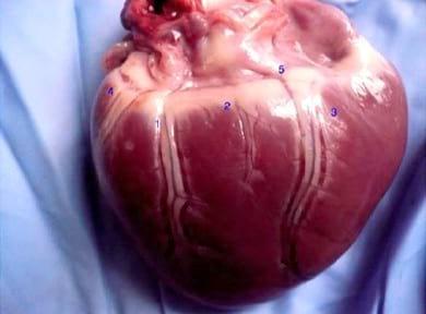 Circulación de la cara caudal del corazón canino: Región quirurgica de la Hemianuloplastia mitral - Image 1