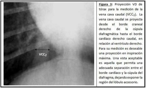 Parámetros Objetivos en la Evaluación Radiológico del Aparato Cardiovascular - Image 2