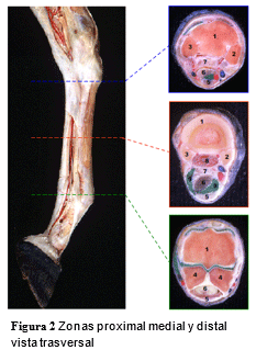 Tendinopatías del tendón flexor digital superficial: diagnóstico y tratamientos - Image 2