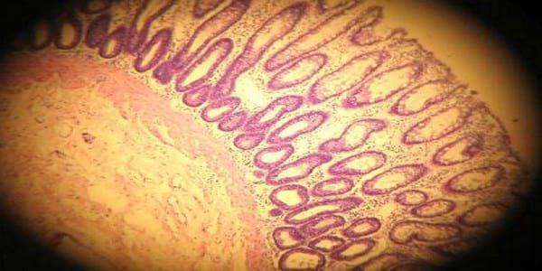 Enterocolitis linfoplasmocitaria con pérdida de proteínas en un Schnauzer mini de 10 meses de edad - Image 2