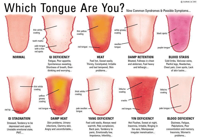 Diagnóstico del paciente mediante el uso de la lengua en Medicina Tradicional China - Image 2