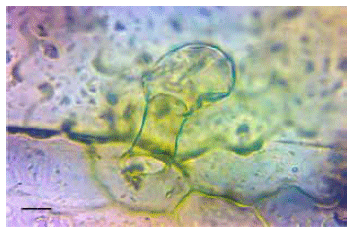 Intoxicación por Cestrum parqui (“duraznillo negro”) en bovinos. Confirmación por análisis micrográfico del contenido ruminal - Image 6