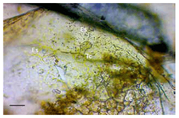 Intoxicación por Cestrum parqui (“duraznillo negro”) en bovinos. Confirmación por análisis micrográfico del contenido ruminal - Image 5