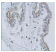 Estrógenos y expresión de la integrina avb3 y fibronectina en la interfase fetoplacentaria durante la gestación porcina - Image 2