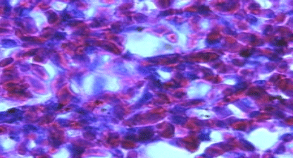 Efecto de un tratamiento con Bromesol y Avlosin sobre el número de macrófagos presentes en el pulmón de pollos parrilleros sanos - Image 10