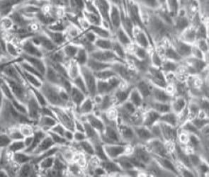 Evaluación de la citotoxicidad de la aflatoxina y la fumonisina en células intestinales de porcino - Image 2