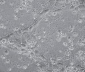 Evaluación de la citotoxicidad de la aflatoxina y la fumonisina en células intestinales de porcino - Image 1