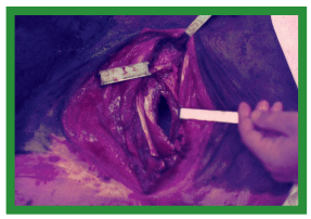 Manual de anestesias y cirugías de bovinos: Cirugías de cabeza, cuello y torax - Image 48