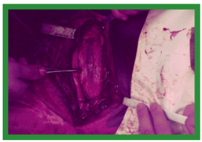 Manual de anestesias y cirugías de bovinos: Cirugías de cabeza, cuello y torax - Image 46