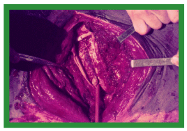 Manual de anestesias y cirugías de bovinos: Cirugías de cabeza, cuello y torax - Image 50