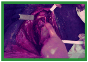 Manual de anestesias y cirugías de bovinos: Cirugías de cabeza, cuello y torax - Image 45