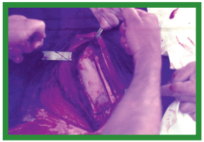 Manual de anestesias y cirugías de bovinos: Cirugías de cabeza, cuello y torax - Image 44