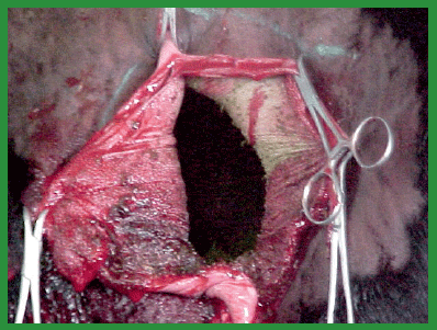 Manual de anestesias y cirugías de bovinos: Cirugías de Abdomen - Image 6