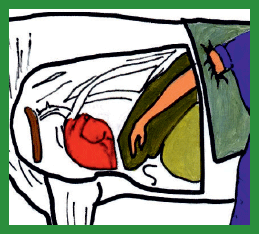 Manual de anestesias y cirugías de bovinos: Cirugías de Abdomen - Image 7