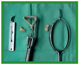 Manual de anestesias y cirugías de bovinos: Cirugías del aparato reproductor de la hembra - Image 40