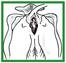 Manual de anestesias y cirugías de bovinos: Cirugías del aparato reproductor de la hembra - Image 24