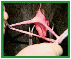 Manual de anestesias y cirugías de bovinos: Cirugías aparato reproductor del macho - Image 3