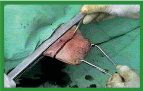 Manual de anestesias y cirugías de bovinos: Cirugías aparato reproductor del macho - Image 27
