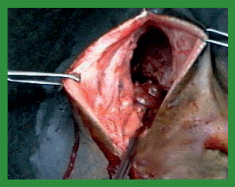 Manual de anestesias y cirugías de bovinos: Cirugías aparato reproductor del macho - Image 43