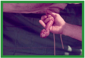 Manual de anestesias y cirugías de bovinos: Cirugías aparato reproductor del macho - Image 34