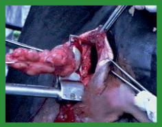 Manual de anestesias y cirugías de bovinos: Cirugías aparato reproductor del macho - Image 44