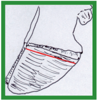 Manual de anestesias y cirugías de bovinos: Cirugías de las extremidades - Image 39
