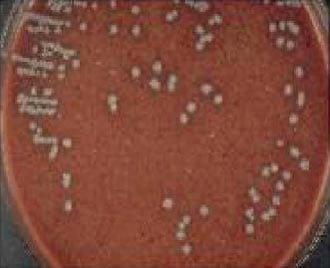 Evaluación comparativa de la efectividad antibiótica del Tylo – Combisone® (tilosina+gentamicina) y Proxifen® 23 L.A.(oxitetraciclina) contra cepas bacterianas causantes de enfermedad respiratoria en bovinos - Image 16