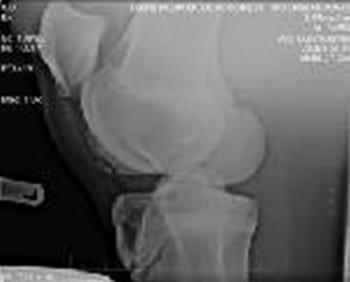 Osteocondrosis en Equinos - Image 4