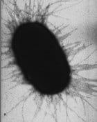 Colibacilosis porcina neonatal - Image 2
