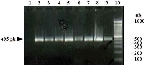 Estudios de contaminación con aflatoxinas producidas por Aspergillus flavus en la castaña y el maní - Image 3