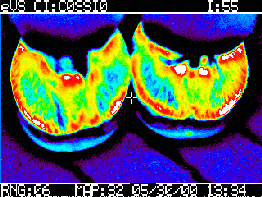 El uso de la termografía en equinos como herramienta complementaria de diagnóstico - Image 13