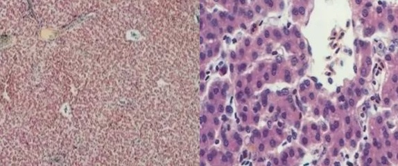Características fisiológicas del hígado de ave | Se adjuntan tres tipos de enfermedad hepática difíciles de diagnosticar. - Image 2