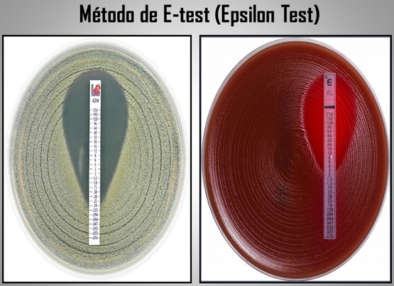 Importancia de los cultivos bacteriológicos en el diagnóstico de la mastitis bovina y antibiograma - Image 20