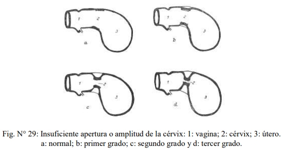 Obstetricia y neonatología bovina: IX. Definición y causas de distocias - Image 3
