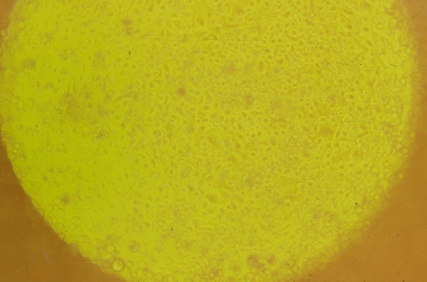 Identificación de biomarcadores de resistencia natural a Mycobacterium bovis en el ganado bovino - Image 7