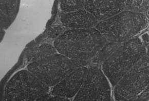 Estudio comparativo de tres cepas vacunales del virus causante de la enfermedad de la bursa en pollos de engorde - Image 1