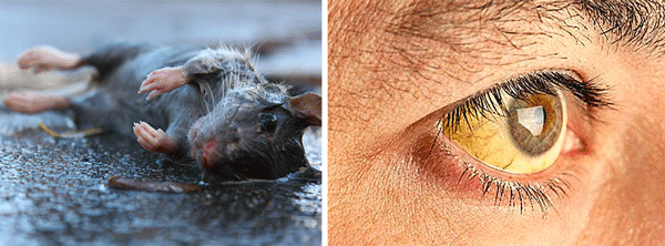 ¿Por qué diagnosticar la leptospirosis?