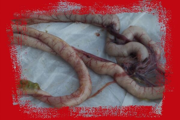 Inflamación intestinal, ¿por qué es importante? - Image 1