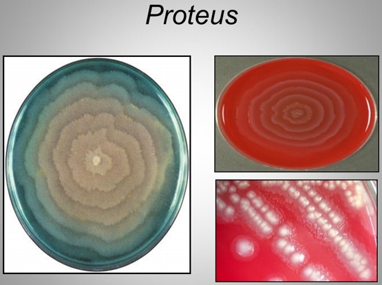 Importancia de los cultivos bacteriológicos en el diagnóstico de la mastitis bovina y antibiograma - Image 15