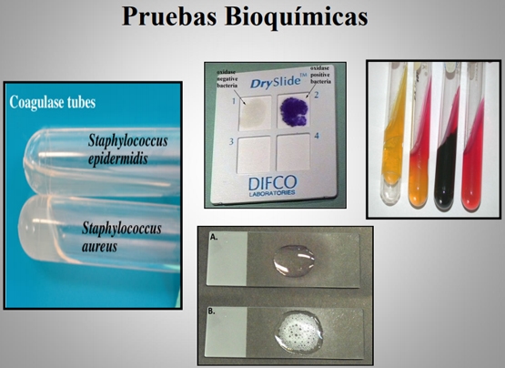 Importancia de los cultivos bacteriológicos en el diagnóstico de la mastitis bovina y antibiograma - Image 17