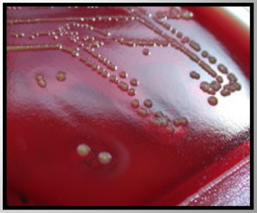 Importancia de los cultivos bacteriológicos en el diagnóstico de la mastitis bovina y antibiograma - Image 6