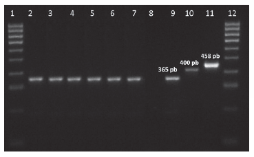 Figura 1. FCorrida electroforética en agar 1,5% de los productos de PCR multiplex. Carril 1 y 12: Marcador de peso molecular. Carril 2 al 7 muestras de sangre, hígado, bazo, riñón, corazón, sistema nervioso central respectivamente. Carril 8: control negativo. Carril 9 al 11: controles positivos de B. bovis, B. bigemina y A. marginale respectivamente.